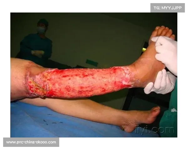 杜埃右大腿受伤与小腿伤无直接关联 疲劳为共同诱因 杜埃右大腿受伤与小腿伤无直接关联 疲劳为共同诱因